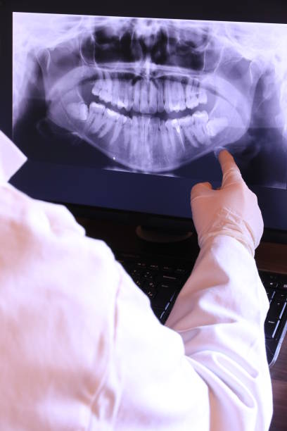 Best Emergency Broken Tooth Repair in Egypt, AL