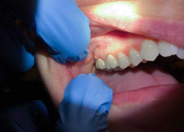 Best Urgent Dental Care in Egypt, AL