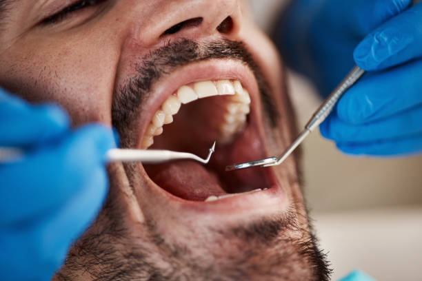 Best Emergency Dental Care for Trauma or Injury in Egypt, AL